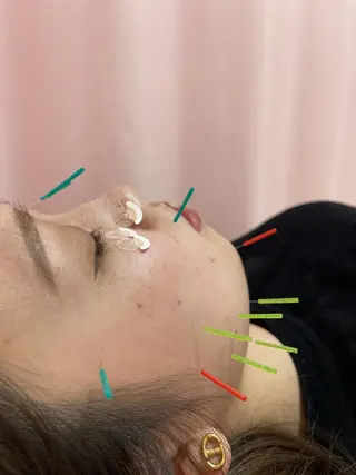 同心整骨院 美容鍼・整体・小顔のエステ・リラクイメージ