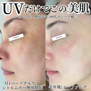 シミケア・肌改善専門 トリニエンス浦和店のエステ・リラクイメージ