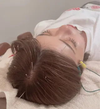 美容鍼＆鍼灸サロン 鍼Glitter.所属・田中 美奈のエステ・リラクイメージ