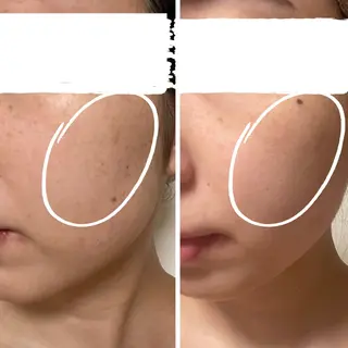 小顔&デコルテ Spa　“koti”のエステ・リラクイメージ