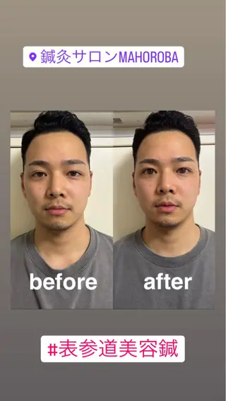 美容鍼灸サロン mahoroba院長のエステ・リラクイメージ