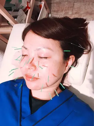 むくみたるみ専門☆ 美容鍼・小顔矯正のエステ・リラクイメージ