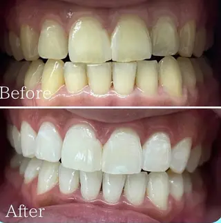 ホワイトニング専門店 WHITE天神店のエステ・リラクイメージ