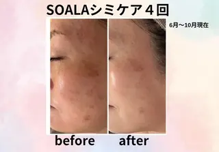 美容整体師  江上のエステ・リラクイメージ