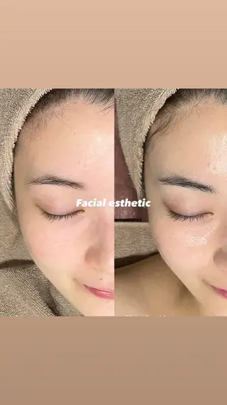 🎀Fuse / non🎀のヘアスタイル