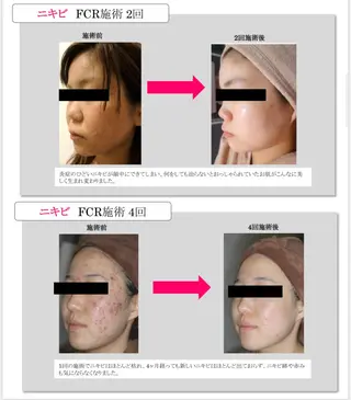 FLEUR大阪・美容 整体・痩身・小顔のエステ・リラクイメージ