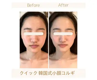 【小顔コルギ＆脱毛専門店⠀】PulBeaute～プリュボーテ～所属・PulBeaute 立川店のエステ・リラクイメージ