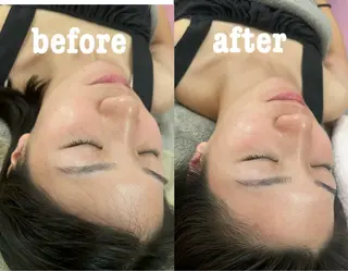 美容鍼灸サロン mahoroba院長のエステ・リラクイメージ