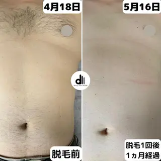 メンズ Beauty Salon MARU所属・新潟市メンズ【脱毛】 MARUのエステ・リラクイメージ