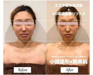 痩身×フェイシャル ブライダル|Linoのエステ・リラクイメージ