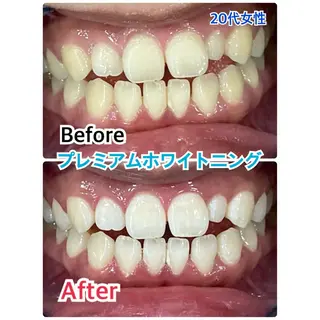 プラチナムビューティー柏所属・【歯科提携】柏ホワイ トニングスタイルのその他イメージ