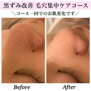 Bellesthe (ベルエステ)のエステ・リラクイメージ