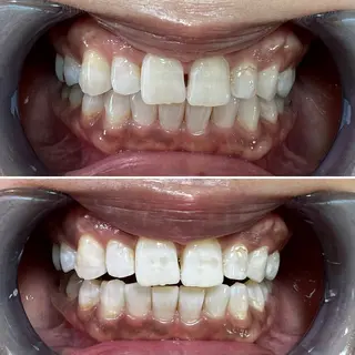 セルフホワイトニング Shineeのエステ・リラクイメージ