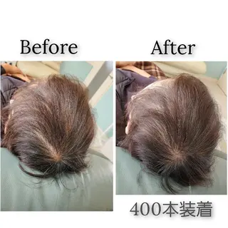 歯科提携セルフダック 宇都宮駒生店のエステ・リラクイメージ