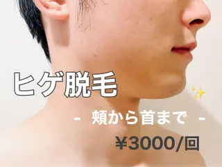 フェイシャル/脱毛 ジョアアンジェ さきのエステ・リラクイメージ