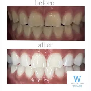 ホワイトニング ショップ本八幡店のエステ・リラクイメージ