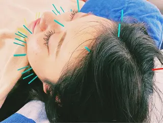 小顔美容鍼専門サロン 渋谷YZのエステ・リラクイメージ