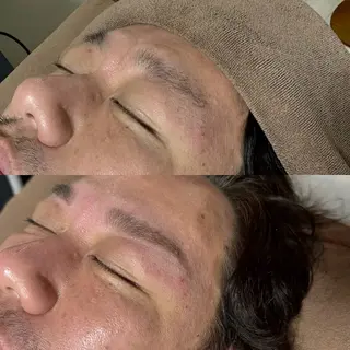 メンズ アイブロウ 六本木脱毛andS 店長Sachiのエステ・リラクイメージ