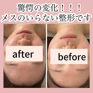 ■超絶小顔&肌管理室■所属・🦋整形級の究極美顔 本格韓国式小顔🦋のエステ・リラクイメージ
