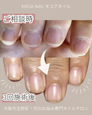 ネイル KIKOA NAIL キコアネイルのネイルデザイン