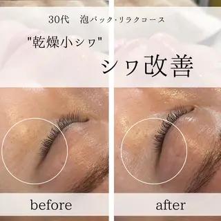 yc.hacci 【ハーブピーリング】のエステ・リラクイメージ