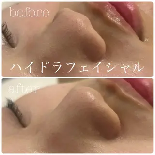 フェイシャルサロン CHIARA 荒田のエステ・リラクイメージ