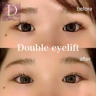 マツエク・マツパ 🩵ANELA東口 齋藤琴音💚のマツエク・マツパデザイン