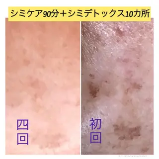 前橋エステサロンきらら所属・エステサロンきらら 瀧澤のエステ・リラクイメージ