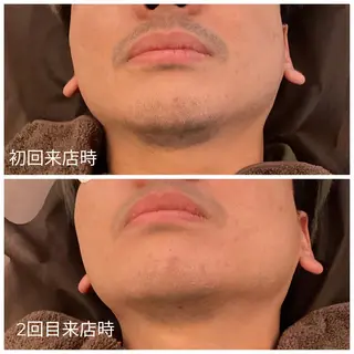 メンズ メンズ脱毛ECXIA所属・men's脱毛サロン ECXIAのエステ・リラクイメージ