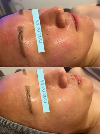 ☆痩身/小顔☆ 結果出します☆のエステ・リラクイメージ