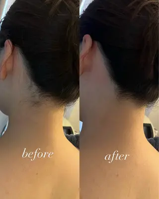 うなじ脱毛/美肌脱毛 LABELのエステ・リラクイメージ