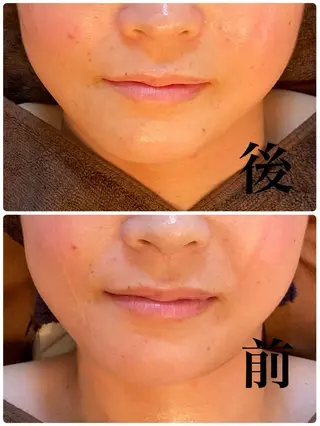 Nao Fukuoka/healingforceN所属・野中 康子のエステ・リラクイメージ