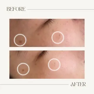 CEsalonEgg 齋藤のエステ・リラクイメージ