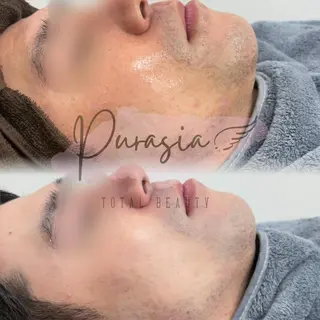 🪞Purasia. 🫧韓国肌管理💎のエステ・リラクイメージ