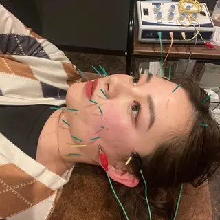 メンズ 美容鍼灸サロン LOMIHARIのエステ・リラクイメージ