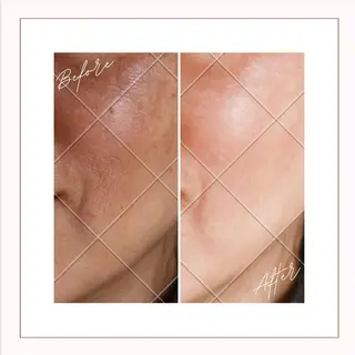 HAKUBI フェイシャルサロンのエステ・リラクイメージ