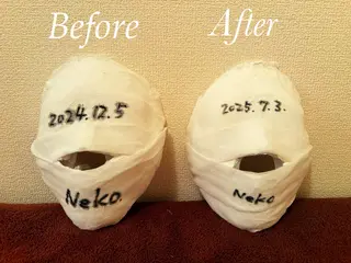 小顔矯正コルギ KOTSUBIのその他イメージ