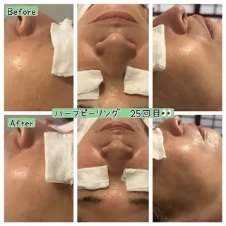 ぱんだ王国エステ所属・ぱんだ王国 エステのエステ・リラクイメージ