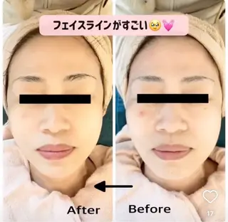 バストアップ専門/ ボディケア/小顔のエステ・リラクイメージ