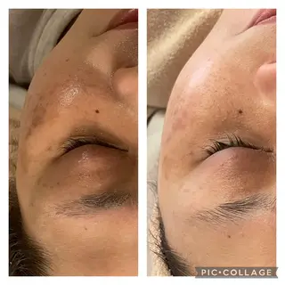 ニキビ改善専門店 d'Albaのエステ・リラクイメージ