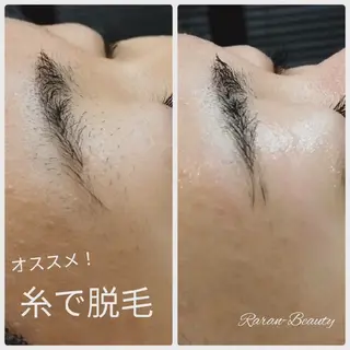 若返り 美肌   エステサロンららんのエステ・リラクイメージ