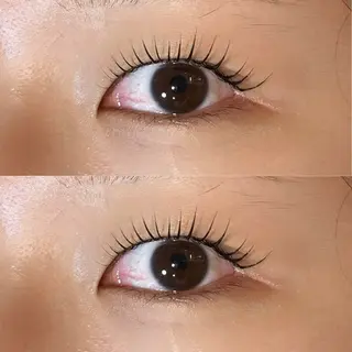 ใใใจใฏใปใใใ ๐๐๐๐๐ ๆ่ฑใฎใใใจใฏใปใใใใใถใคใณ