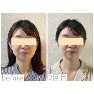 小顔矯正サロン　クレール所属・小顔矯正専門サロン クレールのエステ・リラクイメージ