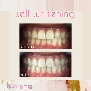 noel de mi 前川亜里沙のエステ・リラクイメージ