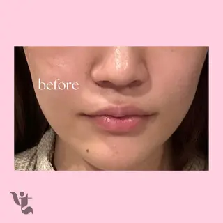 【vidyto】ヴィディトゥ所属・肌管理サロン vidyto MOEのエステ・リラクイメージ