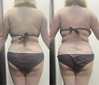 ハイパーナイフ専門店 Salon de COCO所属・Salon de COCOのエステ・リラクイメージ