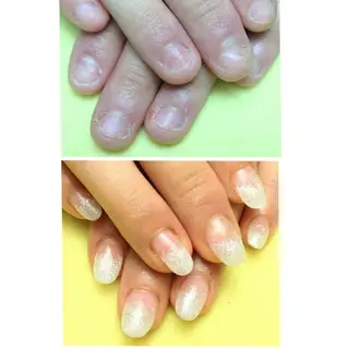 ネイル 深爪矯正/爪育成ケア manie nailのネイルデザイン