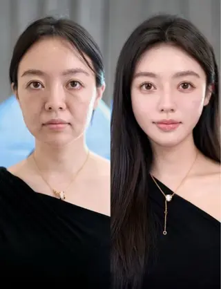 ショート aliaハイフ&水光ジェットサロン所属・aliaハーブ水光店 エステティシャン募集のエステ・リラクイメージ