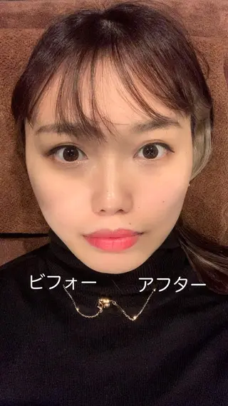 メンズ 美容鍼灸サロン LOMIHARIのエステ・リラクイメージ