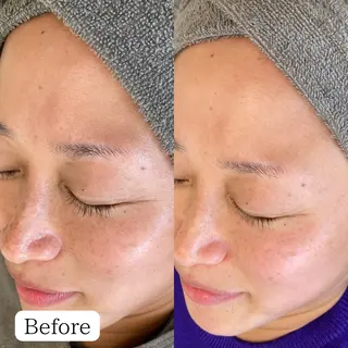 シミケア専門店 &More所属・シミケア専門店 &Moreのエステ・リラクイメージ